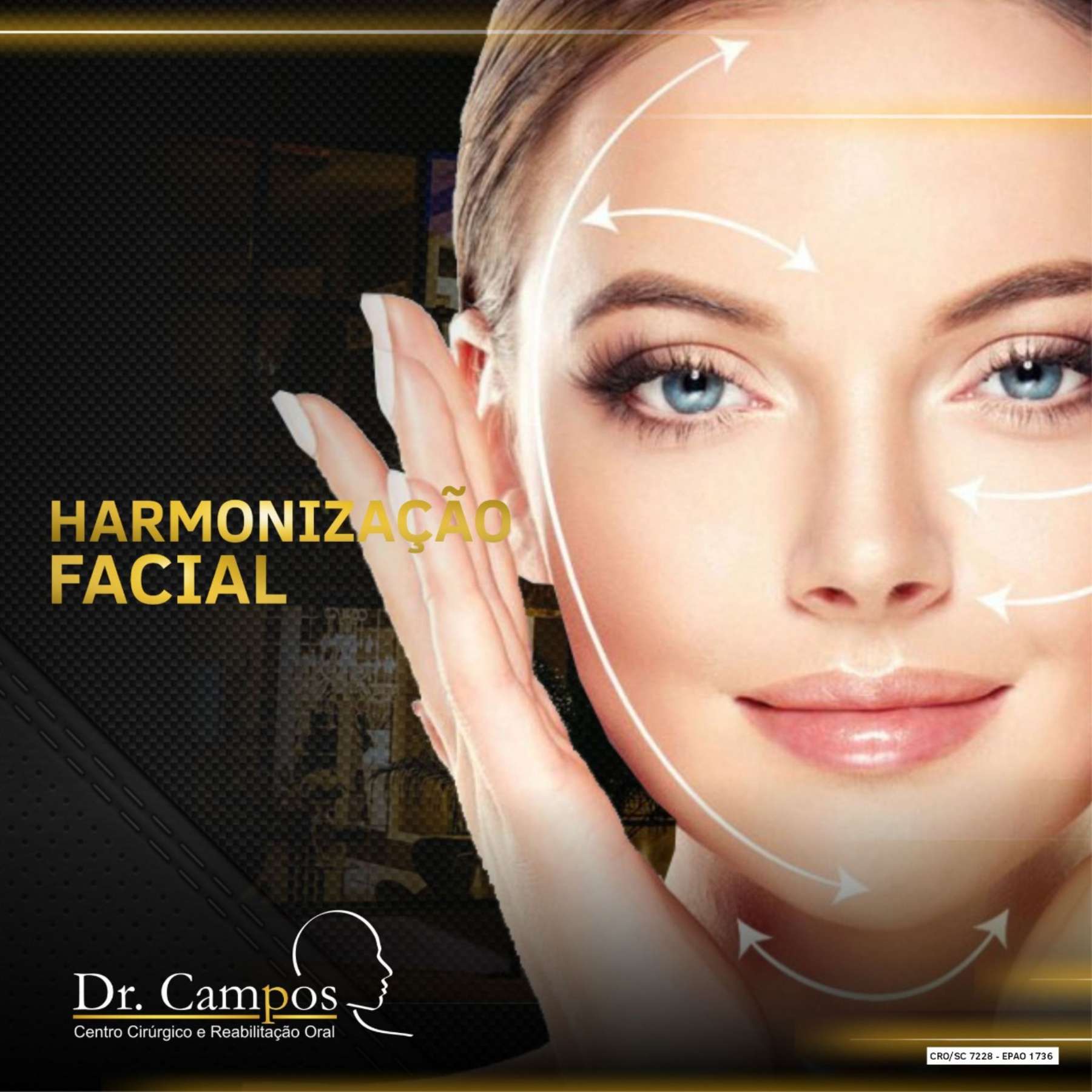 Harmonizao Facial