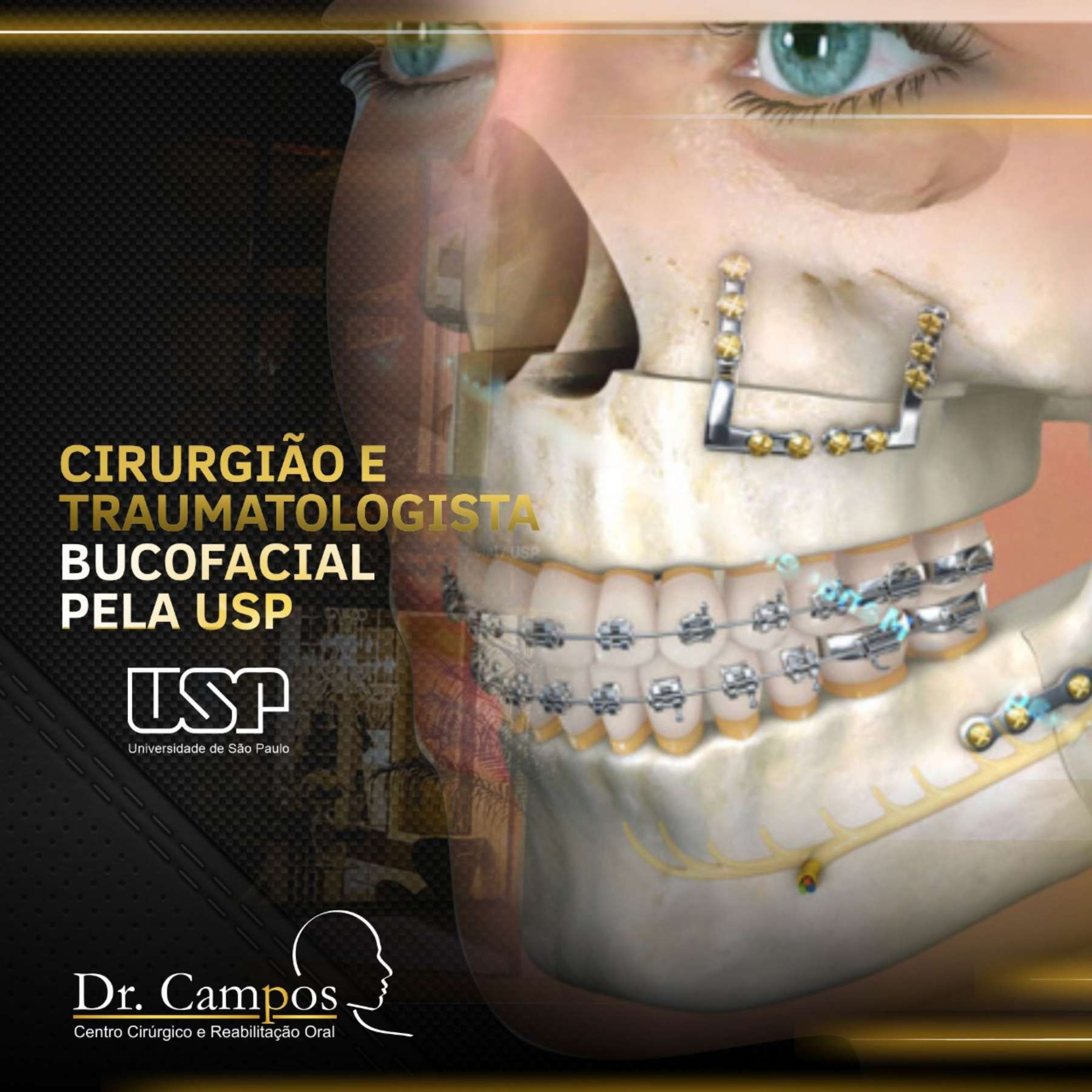 Cirurgia bucomaxilofacial